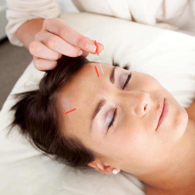 Cosmetic Acupuncture