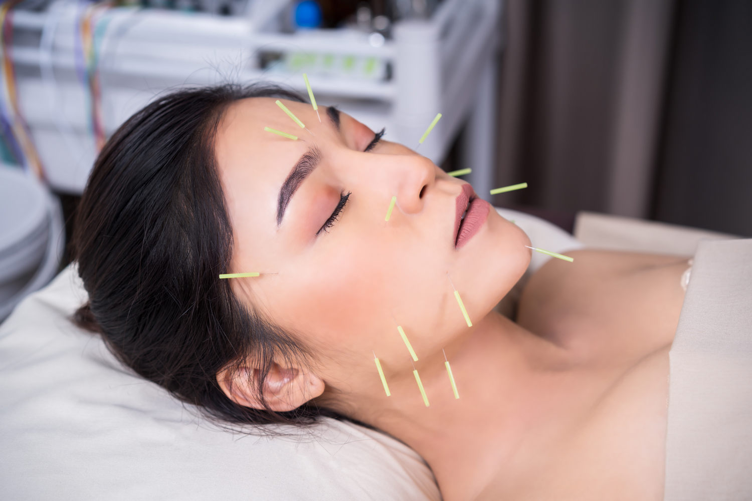 The Rise of Cosmetic Acupuncture