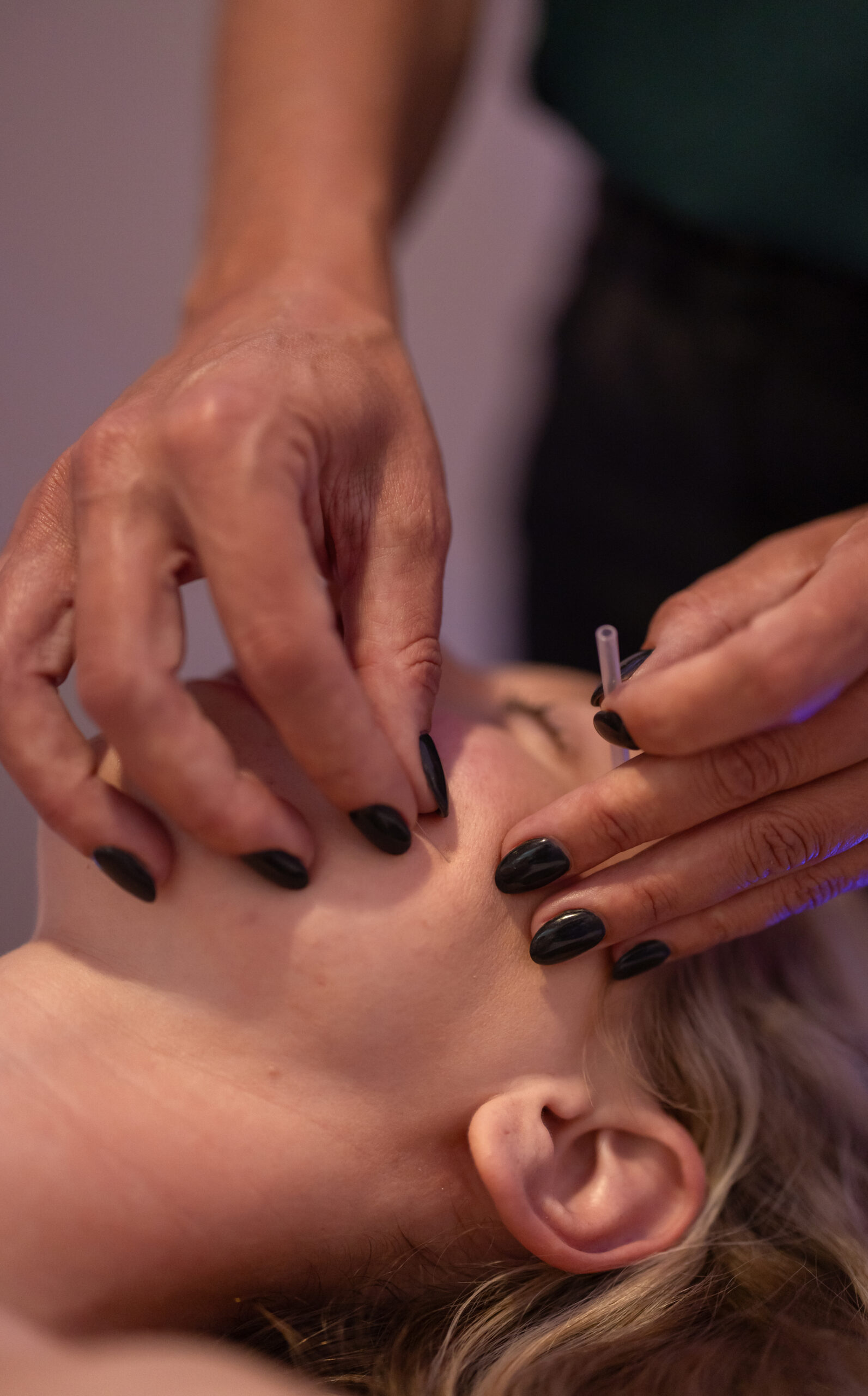 acupuncture relieves tmj pain