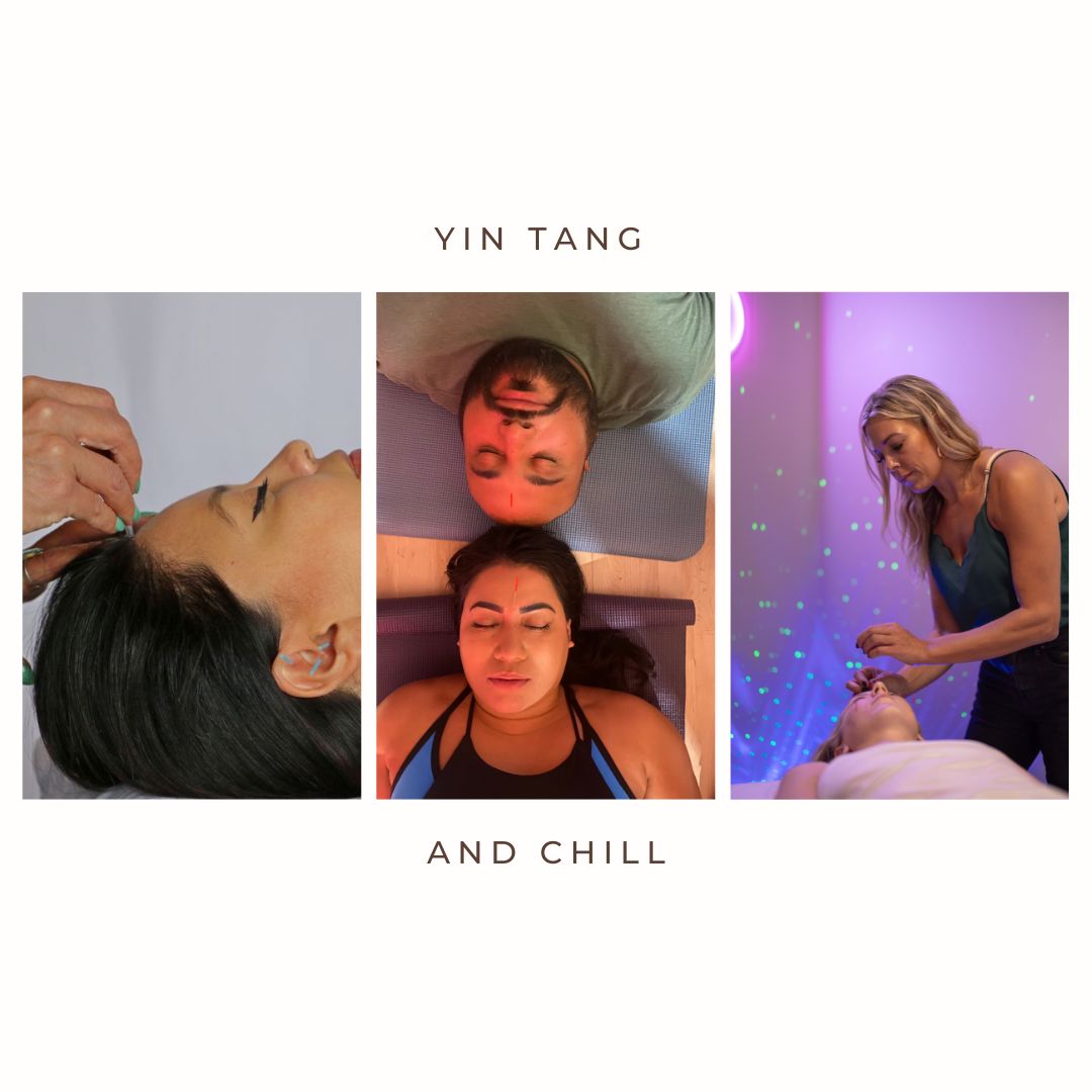 acupuncture improves sleep, improves overall health